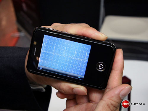 �¼��S���Ƴ�EPI Life�������o(h��)�֙C(j��)